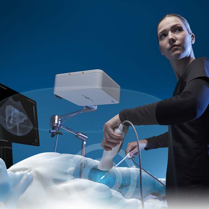 Electromagnetic Tracking Technology