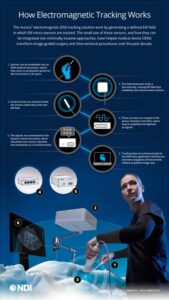 How EM Works Infographic