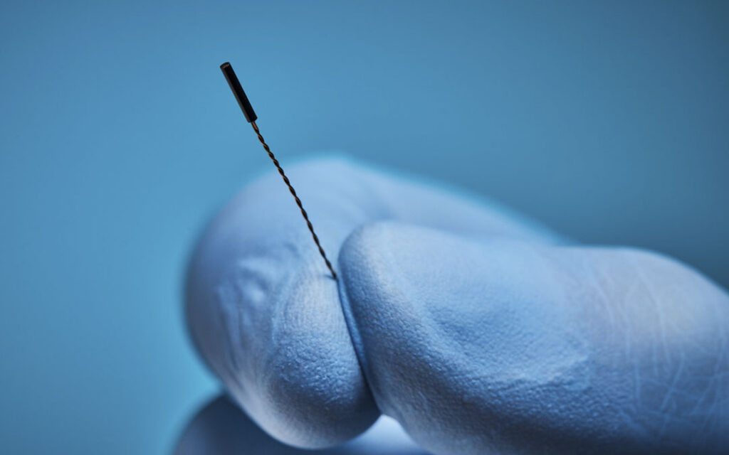 Gloved fingertips holding a miniature cylindrical Aurora electromagnetic sensor coil with twisted lead wire.