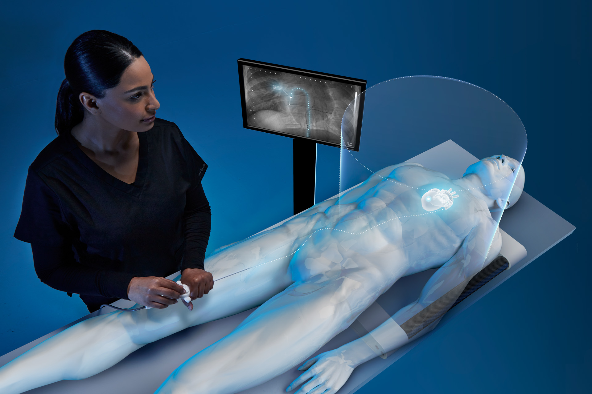 EM Tracking for Cardiology | Catheter & EP Navigation | NDI