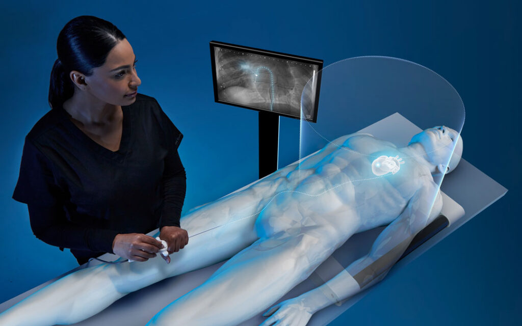 Illustrative rendering of an electrophysiology workflow showing a clinician in dark scrubs guiding a catheter through a patient model's leg, with an overlaid path leading toward a highlighted heart, an Aurora field volume illustrated over the chest, and a monitor displaying anatomical imagery.