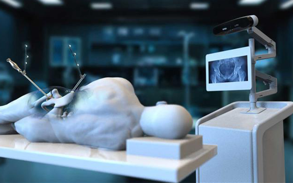 Computer-assisted orthopaedic navigation setup with an optical tracker and cart-based display showing pelvic imaging.