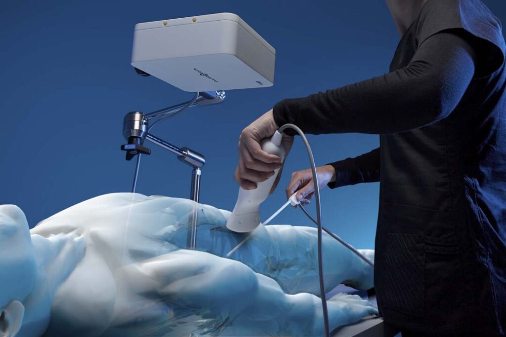 Illustrative rendering of an Aurora field generator mounted on an articulating arm above a patient model, with a clinician in dark scrubs holding an ultrasound-style handheld instrument with an attached sensor cable over the abdomen.