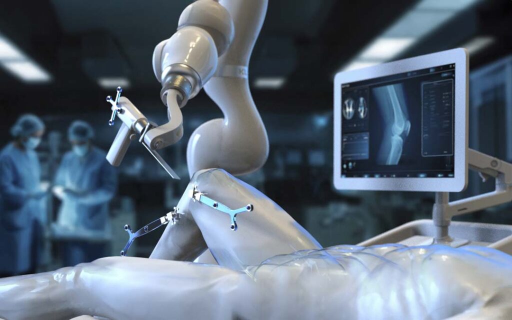 Robotic surgical arm performing a knee procedure, with a tracking reference frame on the patient’s leg and a monitor displaying knee X-ray imaging.