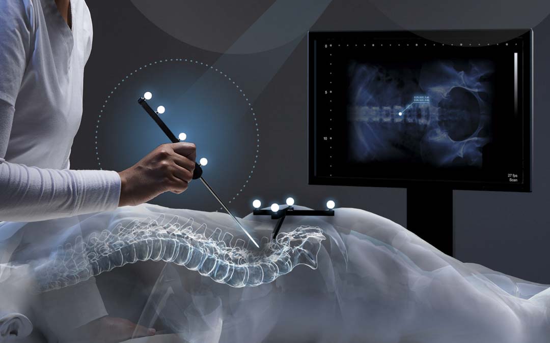 Optical Tracking for Spine & Robotic Surgery | NDI