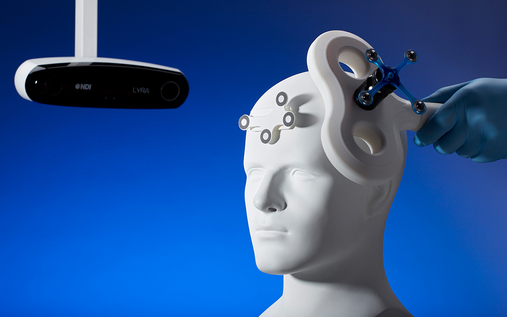 NDI Polaris Lyra optical tracker with passive sphere markers on a head phantom and a tracked instrument.