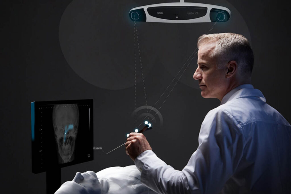 NDI Vega XT optical tracking system tracking a handheld marked tool, with dotted lines showing the line of sight to the tool's markers and a skull scan on a nearby monitor.